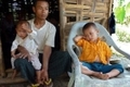 Les deux enfants de ce villageois birman, Tu Raw, montrent des symptômes de la malaria.（Stringer: STR / 2010 AFP）  