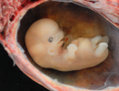 Embryon humain à six semaines de grossesse.（攝影:  / 大紀元）  