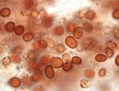 Les échantillons de pluie rouge contiennent une suspension épaisse de cellules qui n’ont pas d’ADN et peuvent provenir de fragments cométaires. (Godfrey Louis/CUSAT)
