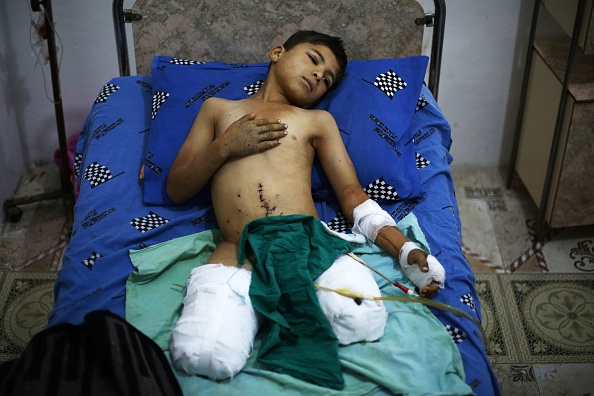 Abd al-Rahman, 10 ans, qui a perdu ses deux jambes dans un pilonnage d'une école de Jisreen, est soigné dans un hôpital de la ville assiégée par les rebelles à l'est de la capitale Damas le 5 novembre 2017. Plus tard mardi, un bombardement rebelle sur le centre de Damas a fait encore trois morts, dont au moins deux civils, et au moins 15 blessés.
(AMER ALMOHIBANY / AFP / Getty Images)