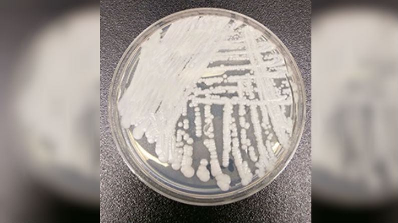 Souche de Candida auris cultivée dans une boîte de Pétri dans un laboratoire du CDC. (Shawn Lockhart/Centers for Disease Control)
