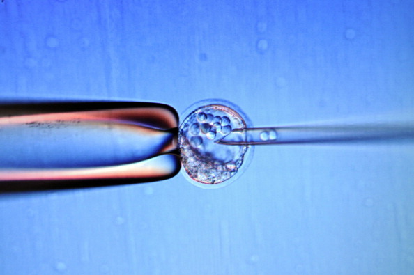 -Gros plan d'un écran montrant une micro-injection de cellules souches d'embryon dans un embryon de souris pour fixer une lignée génétiquement modifiée, au Centre d'immunologie de Marseille-Luminy, afin de comprendre le fonctionnement des gènes. Photo : ANNE-CHRISTINE POUJOULAT / AFP / Getty Images.