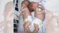 Un médecin trouve quelque chose d’étrange qui pousse dans le ventre d’un bébé, puis il s’inquiète de voir la même chose chez sa petite jumelle