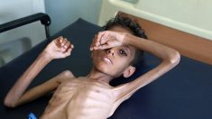 Yémen en guerre : un enfant meurt toutes les 10 minutes frappé par la famine