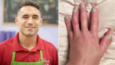 Son épouse perd son petit doigt dans un accident, mais son mari l’aide grâce à une idée ingénieuse