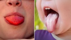 13 choses que votre langue révèle au sujet de votre santé – Une langue rouge vif signifie que vous devriez consulter un médecin