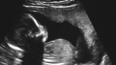 Le gouvernement américain prolonge le contrat pour des souris «humanisées» avec des tissus d’organes de fœtus avortés