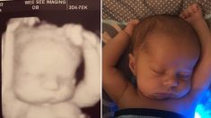 Une échographie montre un «petit gars» dans une position très décontractée dans le ventre de sa mère