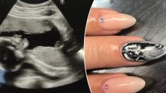 Des futures mamans créent des mini-portraits de l’échographie de leur bébé sur leurs ongles