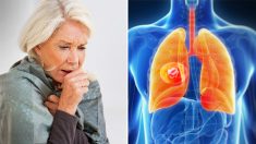 9 signes avant-coureurs du cancer du poumon à surveiller – êtes-vous constamment en train de reprendre votre souffle?