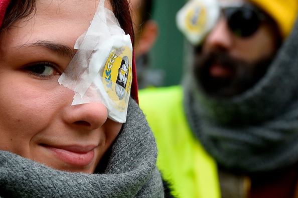 Des "Gilets jaunes" avec un pansement sur l’œil en soutien de Jérôme Rodrigues, "gilet jaune" éborgné lors d'une manifestation, le 2 février 2019 à Nancy. (JEAN-CHRISTOPHE VERHAEGEN/AFP/Getty Images)