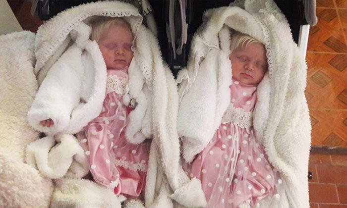 De rares jumelles albinos nées dans la province de Tucumán, en Argentine en 2018.