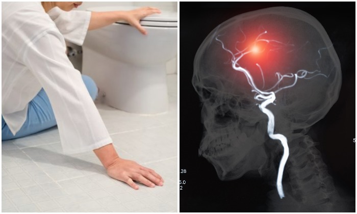 Signes d'accident vasculaire cérébral (Toa55, Par create jobs 51/Shutterstock)