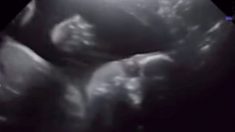 Un fœtus de 28 semaines « salue » sa mère et son père pendant l’échographie