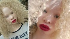 Cette jeune albinos était intimidée pour son apparence – elle reçoit maintenant des appels d’agences de mannequins