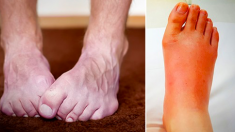 10 choses que vos pieds révèlent sur votre santé – Vos pieds sont-ils froids tout le temps ?