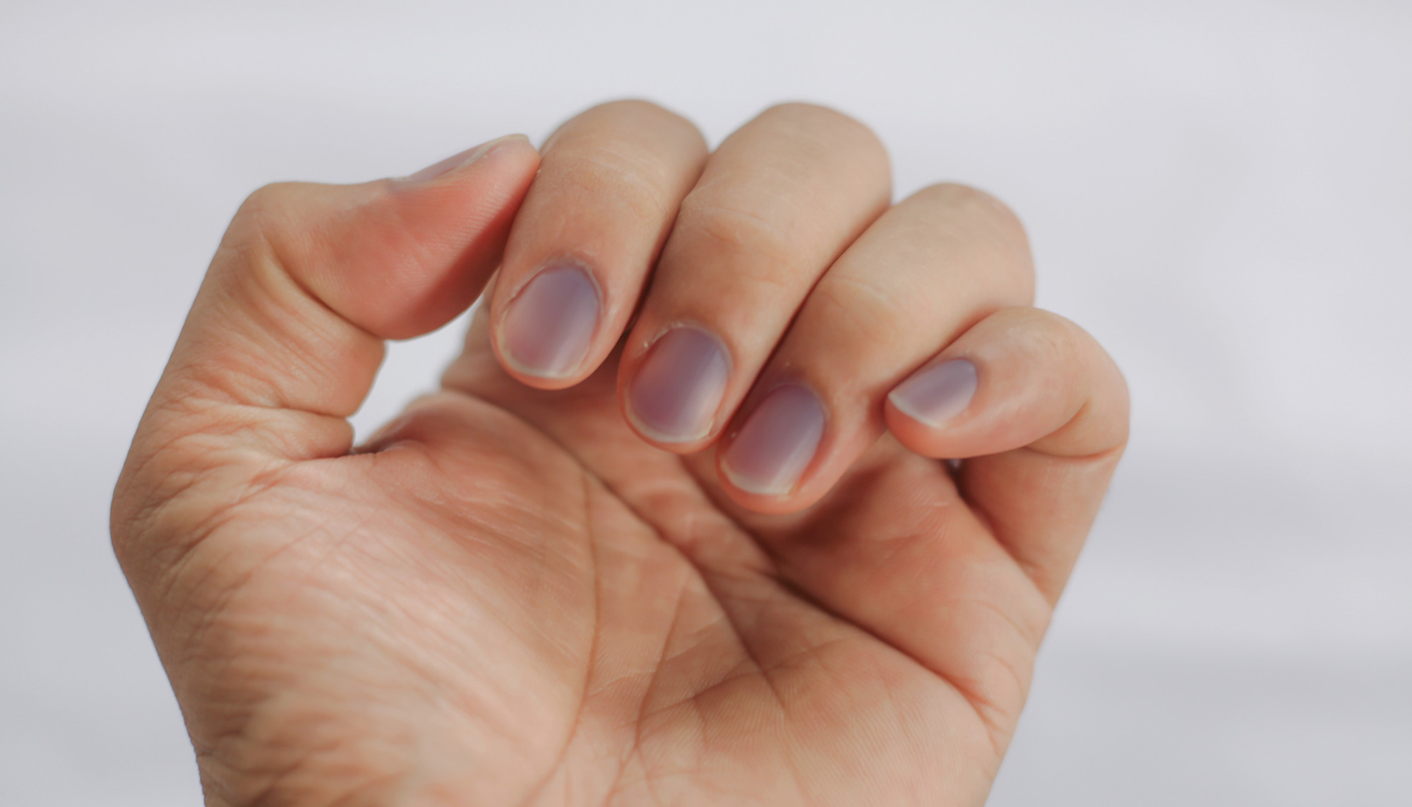 voici-10-aspects-de-vos-ongles-qui-peuvent-aider-vous-renseigner-sur