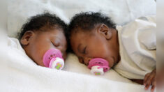 Une naissance sur 2,5 millions : des sœurs siamoises jointes par la tête séparées avec succès