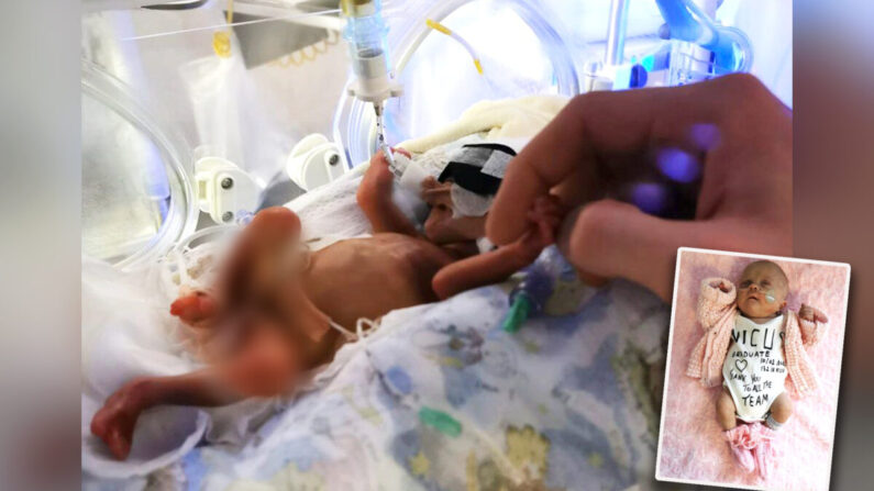 Le bébé Sofia Viktoria Birina pesait à peine 500 g à la naissance, ses chances de survie étaient de 10 % lors de l'accouchement. (Avec l'aimable autorisation d'Inars Birina)