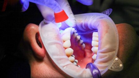 Faute d’accès gratuit aux soins, de nombreux britanniques s’arrachent eux-mêmes des dents