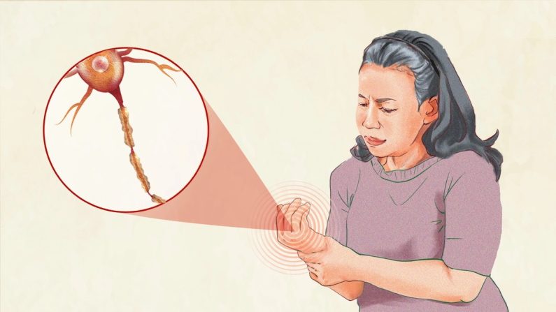 La neuropathie périphérique provoque des douleurs, des sensations de brûlure, d'engourdissement ou de picotements, généralement au niveau des mains et des pieds. (Illustration de Epoch Times, Shutterstock)