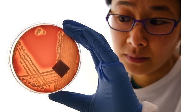 Jean Lee, doctorante à l'Institut Doherty de Melbourne, inspecte la superbactérie Staphylcocus epidermidis sur une plaque de gélose à Melbourne le 4 septembre 2018. - Une superbactérie résistante à tous les antibiotiques connus et pouvant causer des infections « graves », voire la mort, se propage sans être détectée dans les services hospitaliers du monde entier, ont averti des scientifiques australiens le 3 septembre. Des chercheurs de l'université de Melbourne ont découvert trois variantes de la bactérie multirésistante dans des échantillons provenant de dix pays, y compris des souches en Europe qui ne peuvent être maîtrisées par aucun médicament actuellement sur le marché. (Photo credit WILLIAM WEST/AFP via Getty Images)
