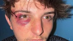 Agression homophobe à Mazamet : trois mineurs sont poursuivis parmi la dizaine d’agresseurs