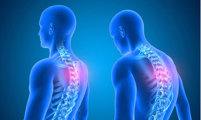 De mauvaises habitudes posturales entraînent le syndrome du croisé supérieur ; voici des étirements simples pour y remédier