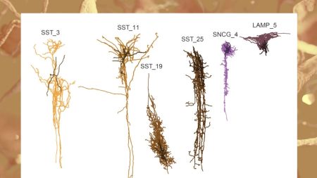 La « phase silencieuse » de la maladie d’Alzheimer commence des décennies avant l’apparition des symptômes